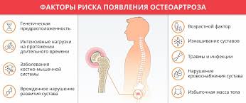Artroz Tazobedrennogo Sustava Koksartroz Deformiruyushij Artroz Osteoartroz Stepeni Simptomy Lechenie
