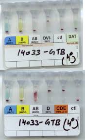 Jan 27, 2017 · method mix smalls amount of each food samples (i. Tulip Blood Grouping Reagents