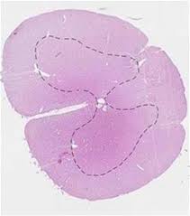 Curiously, with the spinal cord alone, many autonomic functions and even voluntary movements can occur. Spinal Cord Slide Wsu 1 056