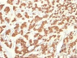 Share your own pictures as public domain with people all over the world. Cytokeratin 18 Krt18 Antibody With Bsa And Azide Mouse Monoclonal Antibody Clone Krt18 835 Ihc If Fc Buy Now Abcepta