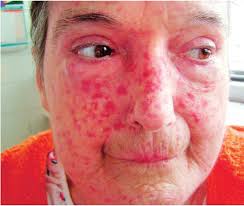 Česká dermato- venerologie