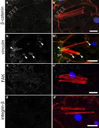 The different types of animal tissues include: Diverse Cell Junctions With Unique Molecular Composition In Tissues Of A Sponge Porifera Evodevo Full Text