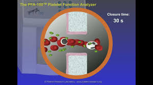 Image result for Platelet Function Closure Time