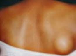 It may feel painful due to radiating pain from another body part or structure, such as from the neck, spine, or shoulder. Https Ispub Com Ijos 14 1 13570