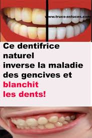 Pin On Astuces Sante Et Bien Etre
