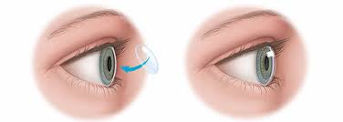 Image result for Cornea
