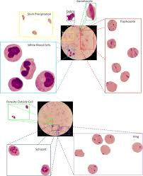 In a stained preparation, they show a thin ring of blue cytoplasm and darkish stained nucleus. Image Analysis And Machine Learning For Detecting Malaria Abstract Europe Pmc
