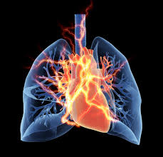 pulmonary fibrosis patients have new lung transplant