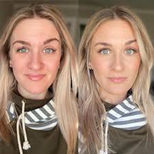 Obsessed to say the least! No more redness! Thanks Heather Creasey for  making my dreams come true!