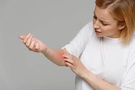 How long does it take to get an allergic reaction. How To Care For Your Skin After An Allergic Reaction Blog