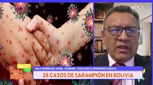 28 CASOS DE SARAMPIÓN EN BOLIVIA