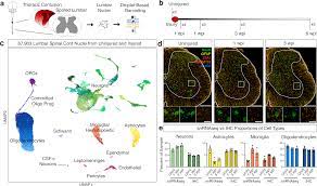 Single cell atlas of spinal cord injury in mice reveals a pro-regenerative  signature in spinocerebellar neurons | Nature Communications
