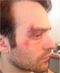 Kingpin lawyer scent alternative idea needed