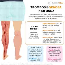 Thrombosis is the formation of a blood clot inside a blood vessel, obstructing the flow of blood through the circulatory system. Spotlightmed Trombosis Venosa Profunda Spotlightmed Facebook