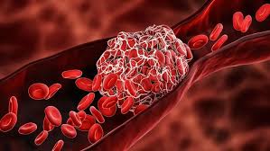 Enhanced Blood Flow