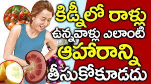Foods To Avoid For Kidney Stones In Telugu I Kidney Stone I Food To Avoid Good Health And More