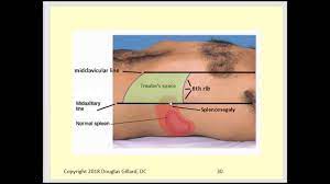 Palpation Of The Liver & Spleen + - Youtube