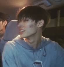Can We Get A Yay For Mingi S Beautiful Bare Acne Songs Kpop Memes Bare Face