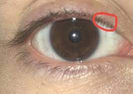 Was Kann Das Sein Am Im Auge Gesundheit Und Medizin Schmerzen Augen
