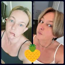 Petsitter shares experience with dog bite