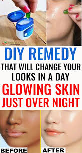 Vaseline With 1 Vitamin E Capsule Can Change Your Skin Overnight Winter Skin Care Skin Care Skin Treatments