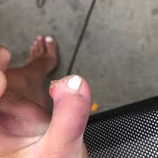 The word piercing can refer to the act or practice of body piercing, or to an opening in the body created by this act or practice. Jewelry James Charles Toe After I Sucked It Off Poshmark