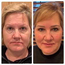 Amplify Aesthetics added a new photo.