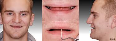 Treatment Decisions: To Remove or To Retain?