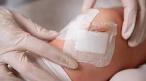 Image result for Wound