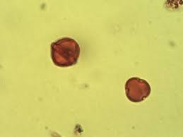 Image result for Scolopia mundii