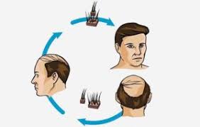 مراكز زراعة الشعر في الرياض المرسال