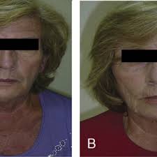 Differences between the cyclooxygenase active sites of COX-1 and COX-2.... 