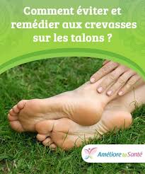 Crevasses Sur Les Talons Comment Y Remedier Ameliore Ta Sante Ameliore Ta Sante Crevasse Sante