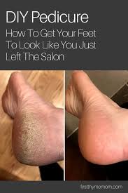 Best Fix For Calluses How I Fixed My Dry Feet First Thyme Mom In 2020 Diy Pedicure Diy Pedicure Soak Diy Foot Soak