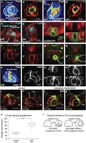 Image result for Monosis