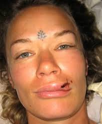 Nuno har skrivit mer om vad som hände