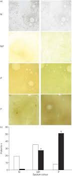 The following is a list of colors. A Sputum Colour Chart B Sputum Colour And Bacterial Colonisation M Download Scientific Diagram