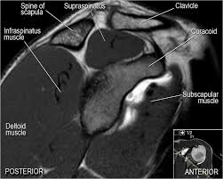 The Radiology Assistant Shoulder Anatomy Mri