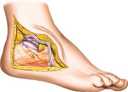 Image result for Calcaneus