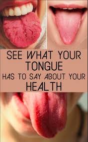 I'm still not over the fact that we have misha collins saying 'use your tongue' preserved in history! Your Tongue Too Be Sure To Also Check Out How To Use Coconut Oil Oil Pulling To Improve Your Dental Health And Hygiene Tongue Health Health Natural Medicine
