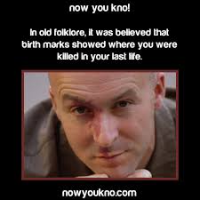 Birthmarks Are Where You Were Killed So My Stomach And The Side Of My Right Calf Weird But True Weird Facts Facts