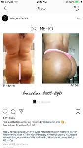 At mia aesthetics, we give our patients many different payment options . My Bbl Journey My Doctor Is Going To Be Ghassan Mehio From Mia