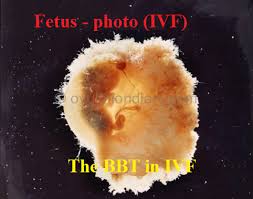 Is The Basal Body Temperature In Ivf Informative Or Not