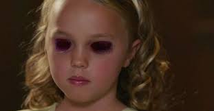 What Happened to Rose's Eyes