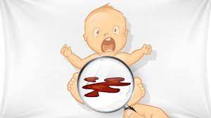 Reagiert das baby allergisch auf beispielsweise kuhmilch, wird diese als fremdstoff im körper eingestuft. Stuhlgang Beim Baby Das Bedeutet Der Windelinhalt