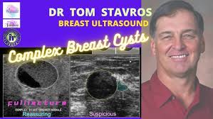 Breast Ultrasound- The Complex Mass (Sonography in Seconds Series)