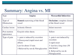 16 symptoms of unstable angina and myocardial infarction by diagnosis. Ppt Ischemic Heart Disease Powerpoint Presentation Free Download Id 175510