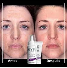 Adiós a las manchas