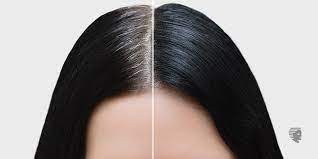 Take half a cup of rosemary and half a cup of sage and boil in water for 30 minutes. 7 Home Remedies For Grey Hair Treatment Ahs Uae