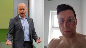 Peter Canavan believes there is an 'agenda' against the Red Hand county as  Tyrone GAA condemn 'unwarranted violence'